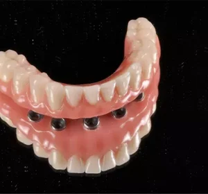 AnyConv.com__Camada 10