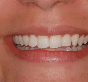 AnyConv.com__Camada 12