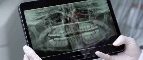 close-up-dentist-instruments