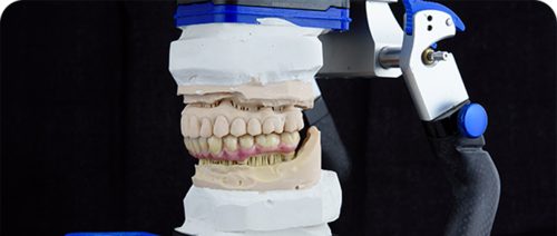 teeth-ceramics-dentures-printed-acrylic-model-articulator-dental-lab